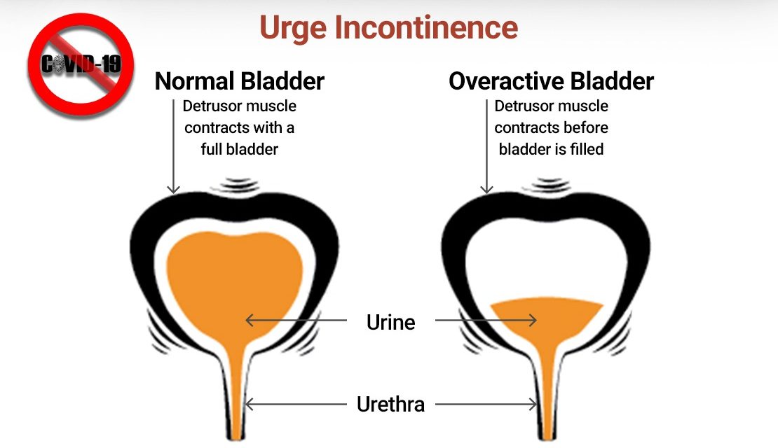 https://www.southerncrescent.com.my/wp-content/uploads/2021/08/FREQUENT-URINATION-TREATABLE-NOT-A-LIFE-SENTENCE-SOUTHERN-CRESCENT-SDN-BHD-NEGERI-SEMBILAN-WHATSAPP-0199199334-1110x640.jpg