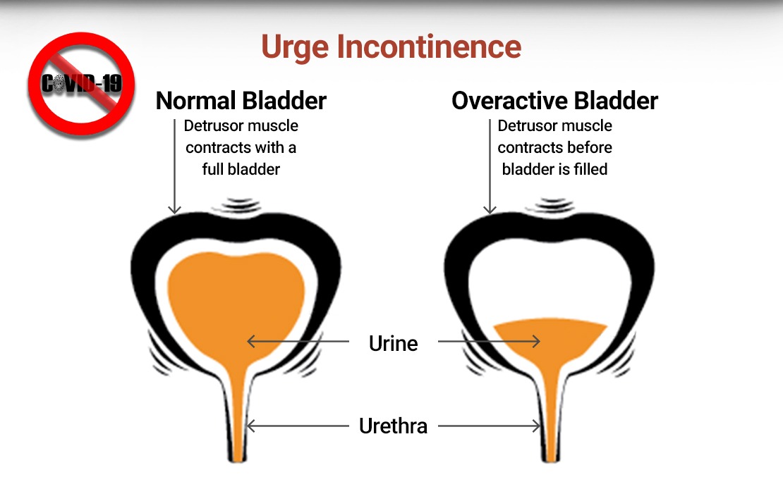 FREQUENT URINATION TREATABLE NOT A LIFE SENTENCE Southern Crescent 